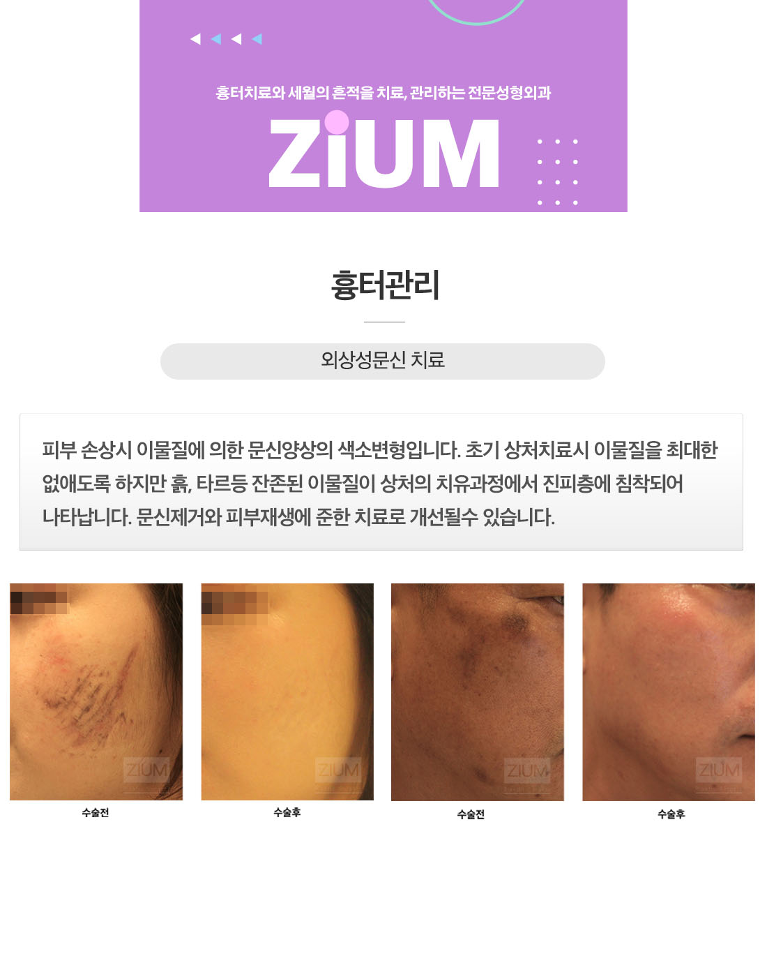 zium02.jpg